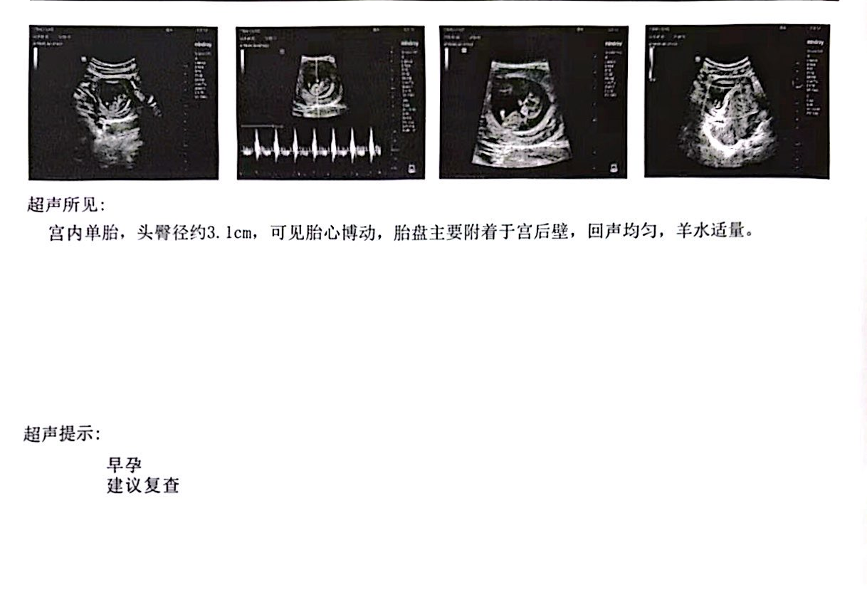 助孕2.png