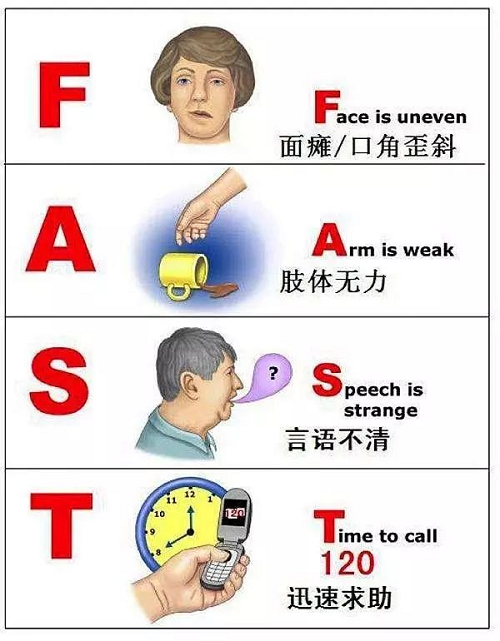 卒中1.png